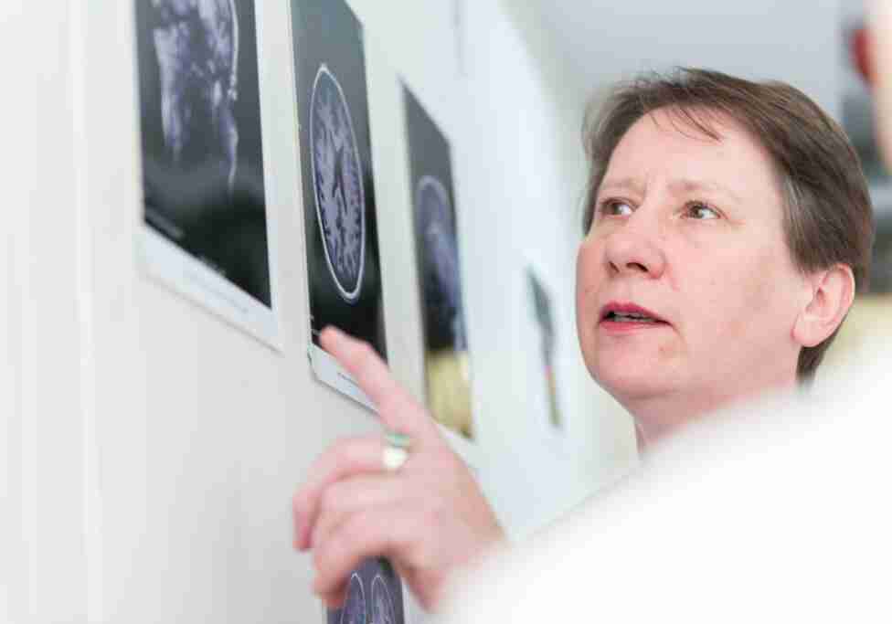 Doctor pointing at brain scan